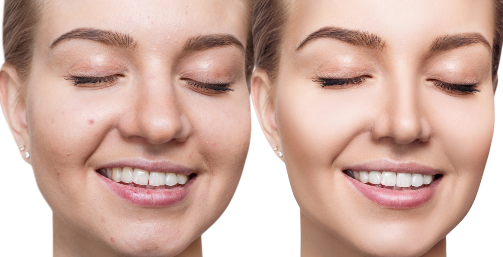 Brush vs Sponge, Mana yang Lebih Cocok untuk Anda? Beauty Journal